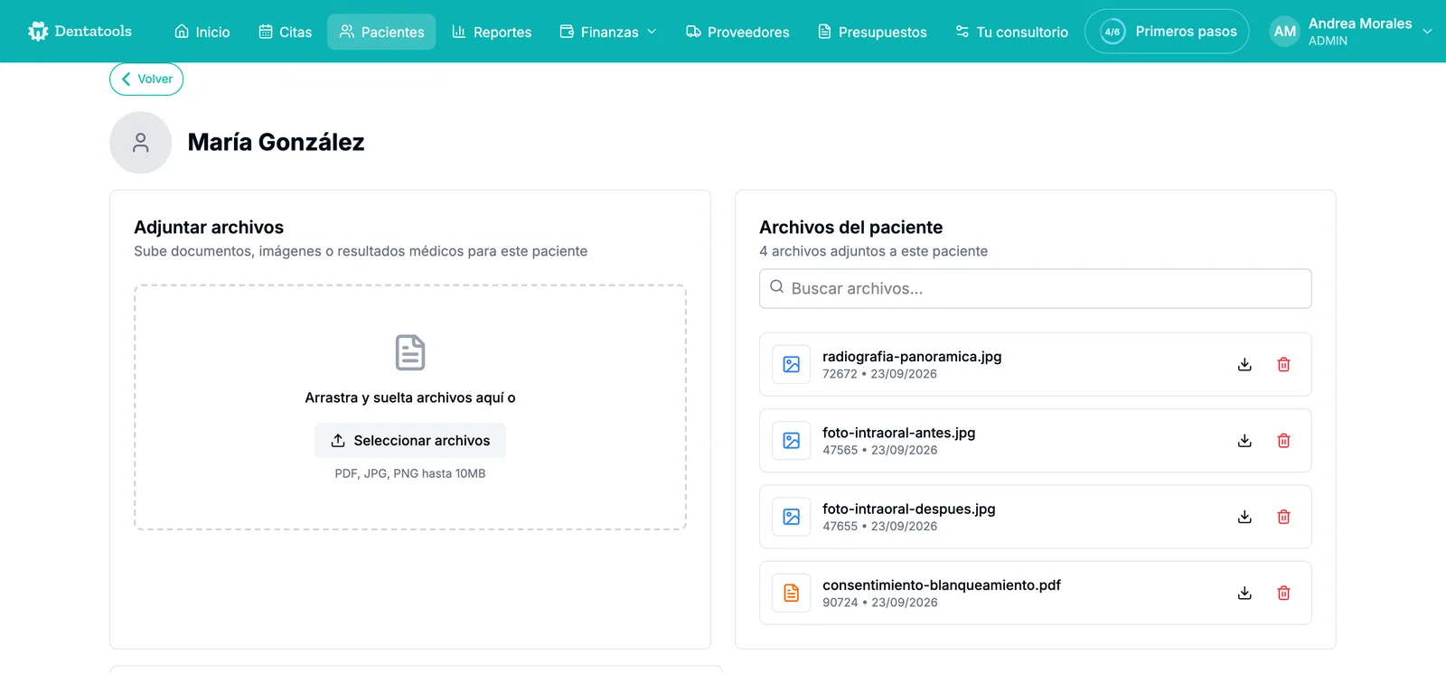 Pestaña Archivos de Dentatools con el recuadro Adjuntar archivos y la lista de archivos del paciente: radiografía panorámica, fotos intraorales de antes y después y un consentimiento en PDF